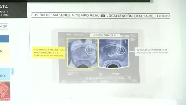 Koke, embajador de la campaña &#039;Pasa la prueba&#039; contra el cáncer de próstata