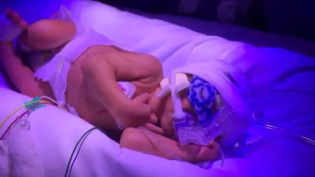 Día Mundial del Niño Prematuro