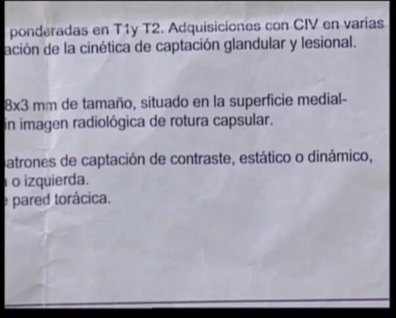 Las diez cosas que debes saber si llevas implantes mamarios PIP