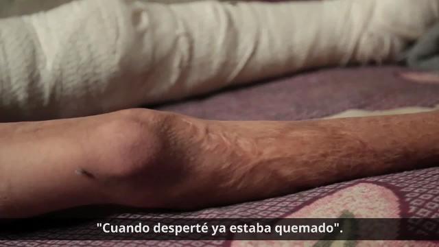 ¿Cómo está Yemen después de 4 años de guerra?