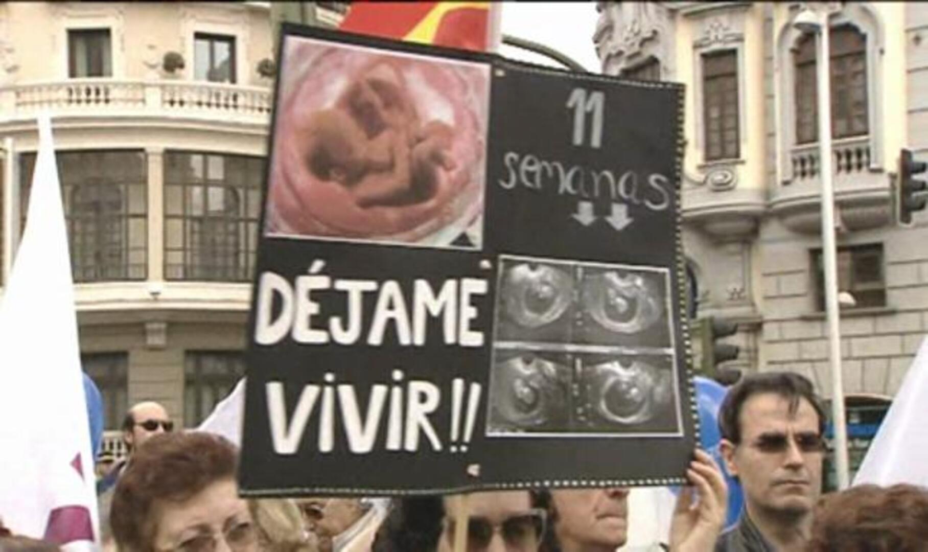 Gallardón anuncia que la malformación del feto no será ya un supuesto para abortar