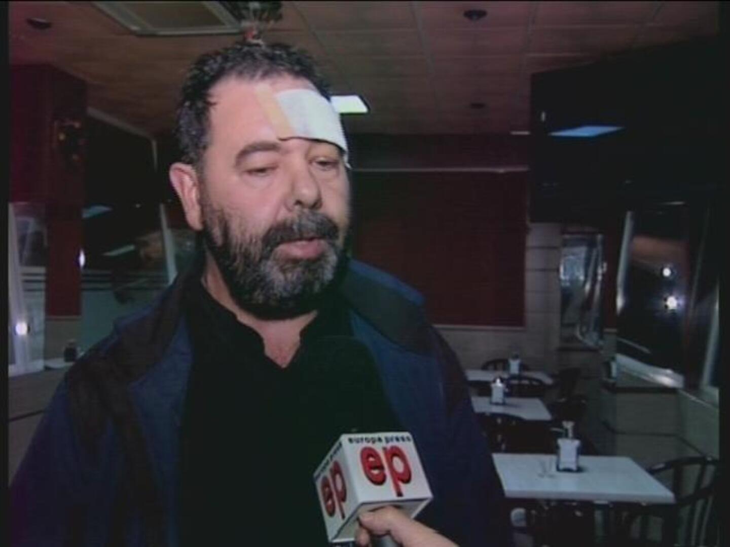 Puntos de sutura a cuenta de la ley antitabaco