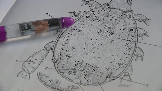 Fallece un hombre con fiebre hemorrágica tras picarle una garrapata en Badajoz