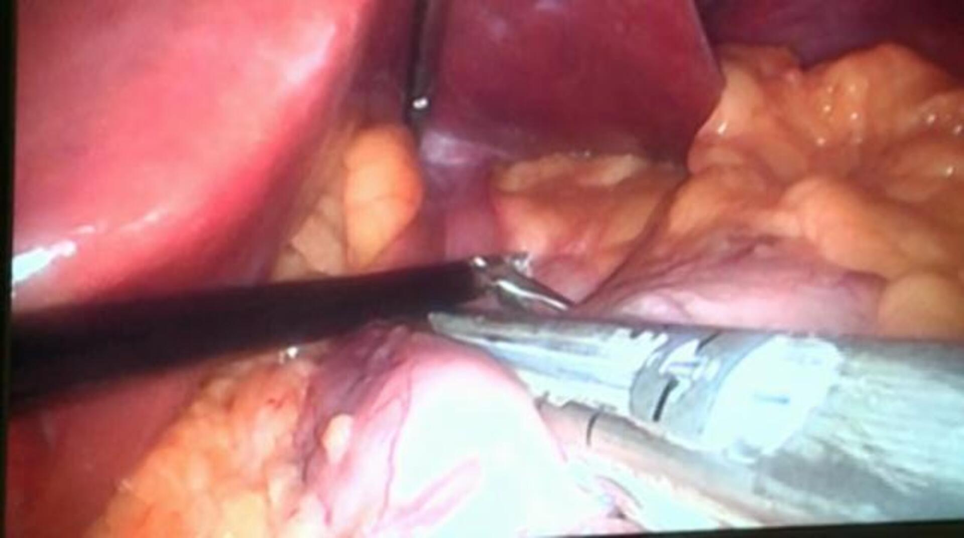 Número de donantes por millón de habitantes por comuniades autónomas