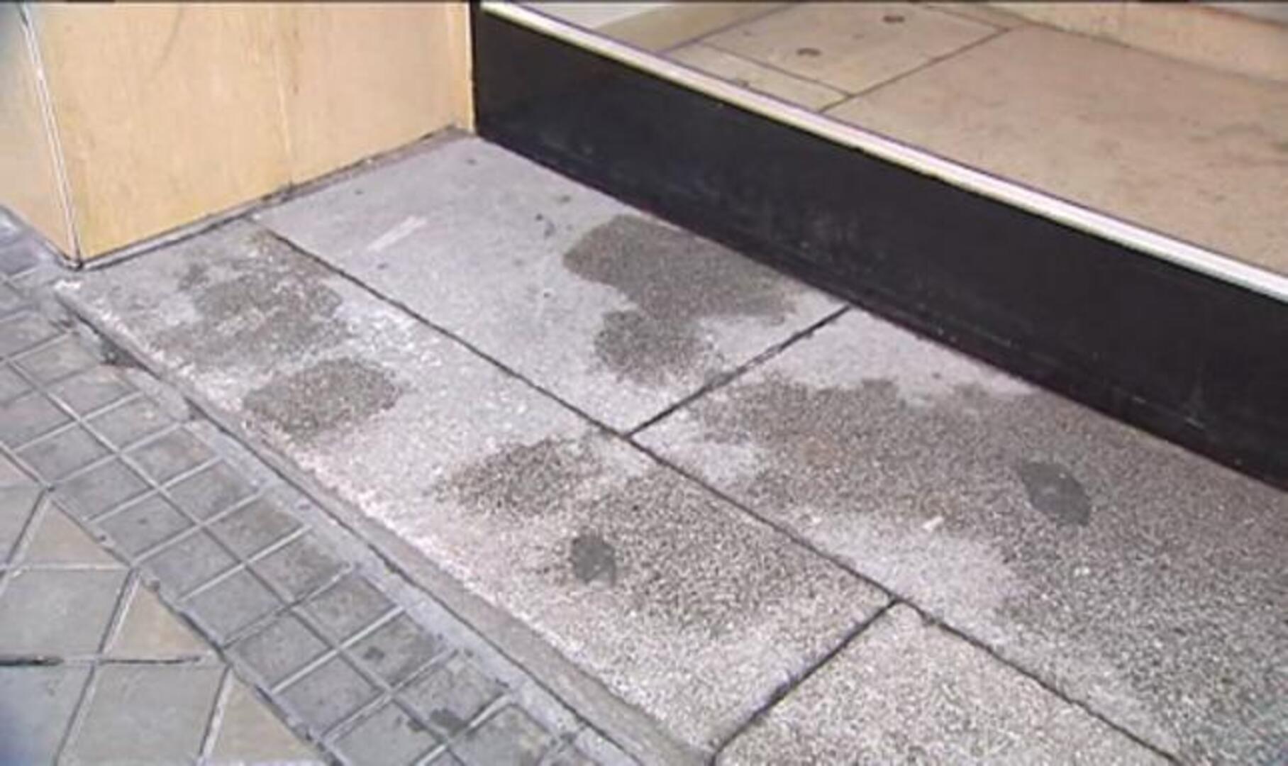 La mujer rociada con ácido tiene el rostro desfigurado