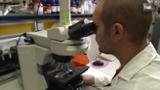 HDL Algas microscópicas contra el cáncer