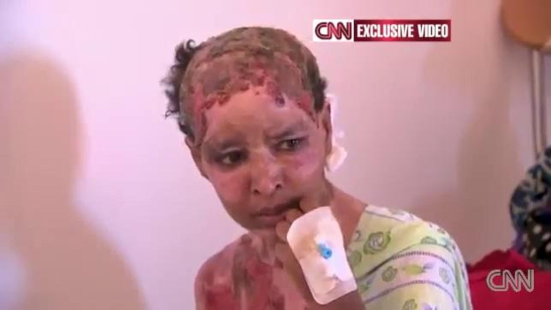 La niñera a la que quemó viva la mujer de un hijo de Gadafi