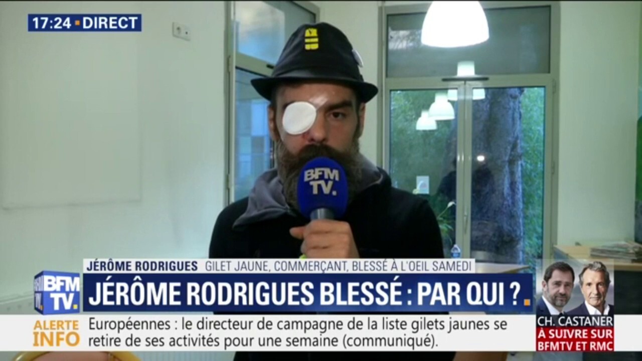 Le Gilet Jaune Jérôme Rodrigues Affirme Que Sa Blessure à Lœil A été Causée Par Un Impact Et Non Pas Des éclats De Grenade